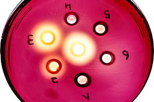 Different test substances on a petri dish 